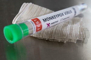 illustration Mexique : positif à la variole du singe, un Américain s’enfuit d’un hôpital